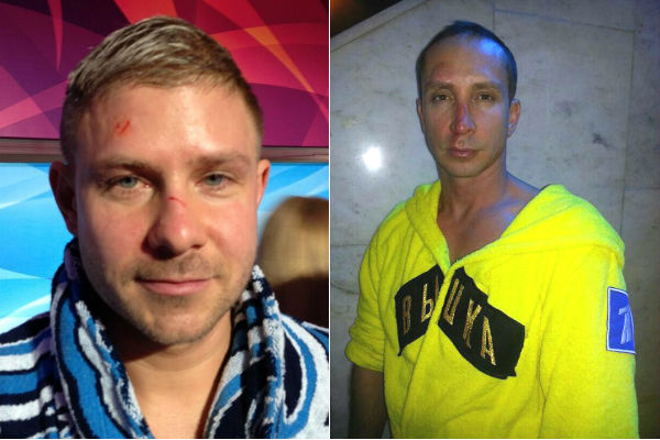 Выныривая, Митя Фомин и Данко ободрали лоб и нос об понтон, на котором стояли ведущие шоу. Плавучую сцену не подсветили, и она слилась по цвету с водой Выныривая, Митя Фомин и Данко ободрали лоб и нос об понтон, на котором стояли ведущие шоу. Плавучую сцену не подсветили, и она слилась по цвету с водой