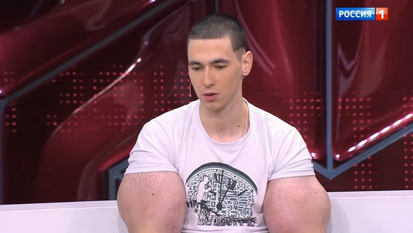 Кирилл отрицает, что ему могут ампутировать руки Кирилл отрицает, что ему могут ампутировать руки