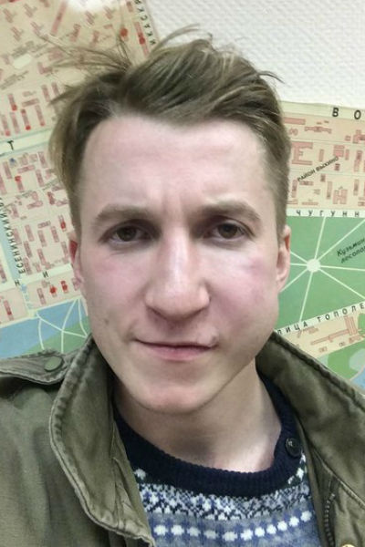Артист выложил множество снимков, демонстрирующих следы побоев на его лице Артист выложил множество снимков, демонстрирующих следы побоев на его лице