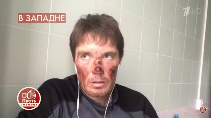 Экскурсовод сам получил серьезные травмы Экскурсовод сам получил серьезные травмы