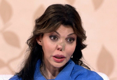 Точно сифилис? Врач вывел Алису Аршавину на чистую воду