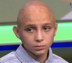 12-летний Арсений, обварившийся в кипятке, мечтает стать футболистом и победить хейт сверстников