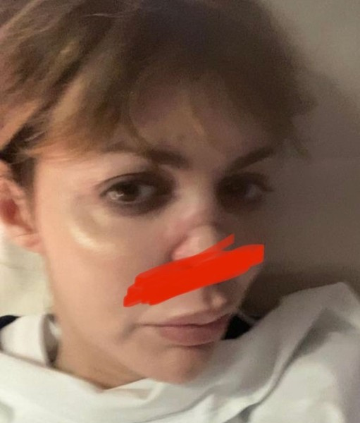 Аршавина в тяжелом состоянии Аршавина в тяжелом состоянии