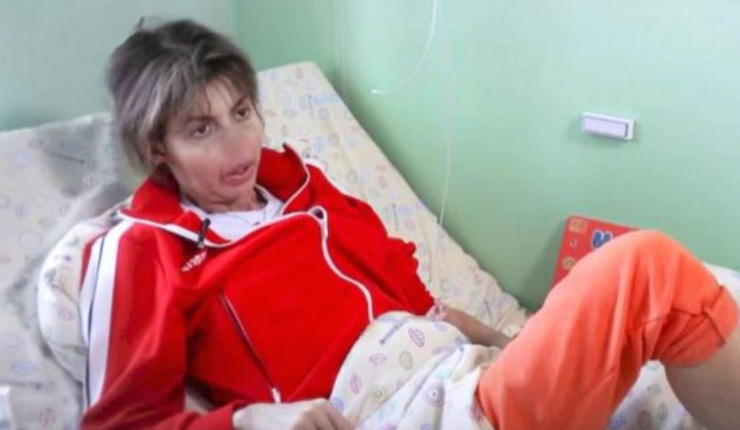 Когда Алиса Аршавина сможет восстановить изуродованное лицо? Разбор хирурга