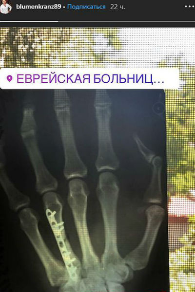 Валерий показал постоперационный снимок Валерий показал постоперационный снимок