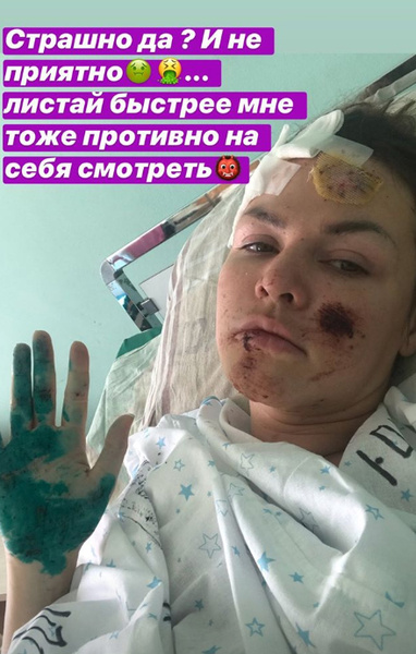 Евгения после аварии Евгения после аварии