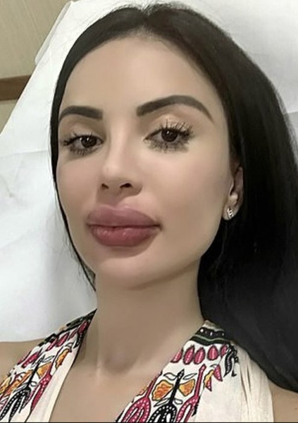 После процедуры девушке стало плохо После процедуры девушке стало плохо