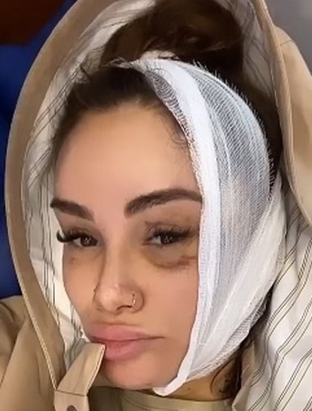 Айза вывихнула челюсть Айза вывихнула челюсть