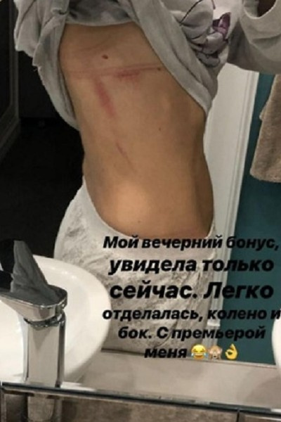 Екатерина Волкова получила травму в театре Екатерина Волкова получила травму в театре