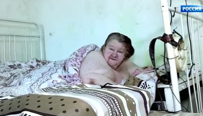Самая тяжелая женщина в мире похудела на 100 килограммов
