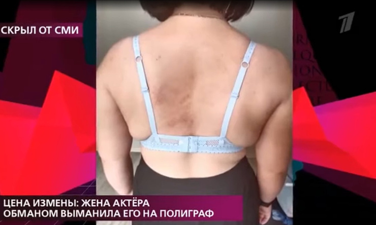 Женщина получила травмы по всему телу