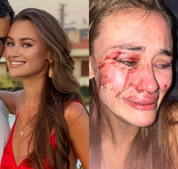 Появилось видео избиения топ-модели Дарьи Кирилюк в Турции